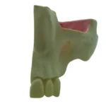 Orbital Bone Medio Maxilar con Base de Cráneo Ausencia Parcial - Imagen 2