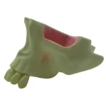 Orbital Bone Medio Maxilar con Base de Cráneo Ausencia Parcial - Imagen 3